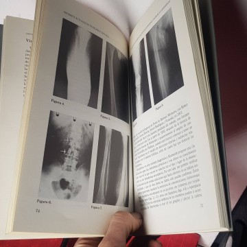 Libro de medicina criterios actuales de la patología linfática j. A. Jiménez Cossío