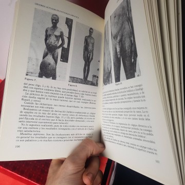 Libro de medicina criterios actuales de la patología linfática j. A. Jiménez Cossío