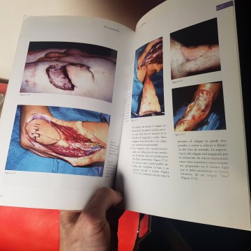 Libros de medicina librería guía para el cuidado de las heridas compra
