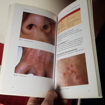 Enfermedades cutáneas comunes libro dermatología medicina libros