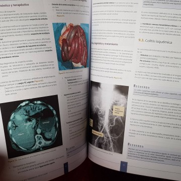 Manual CTO de medicina y cirugía aparato digestivo cirugía general MIR