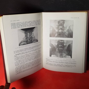 Patología del esófago tórax raquis y mamas libro medicina antiguo