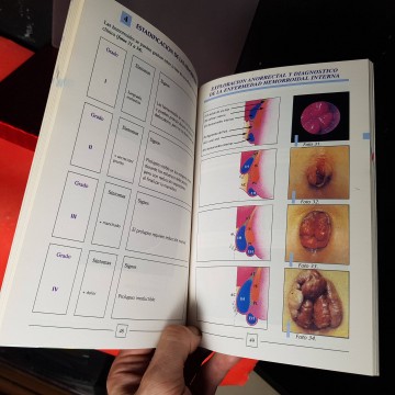 Atlas de hemorroides clases de hemorroides tratamiento libro medicina