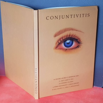 Libros de oftalmología medicina conjuntivitis libro librería online
