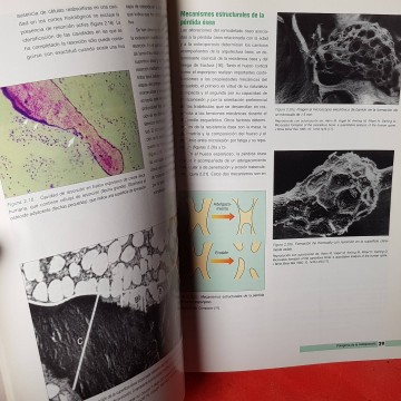 Libros de medicina librería osteoporosis ilustrada hostiopatia libro