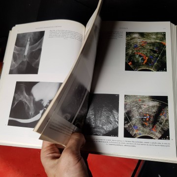Diagnóstico por imagen de la próstata libro medicina radiología
