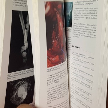 Libro angiologia tratado de aneurismas Esteban Solano libros medicina