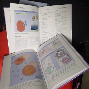 Enfermedad pulmonar obstructiva crónica EPOC atlas de neumología
