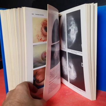 Oncología en ginecología libro Manual J González Merlo libro Manual