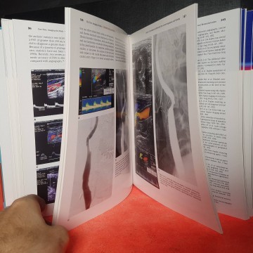 Libros angiología vascular diagnosis . M. ashraf mansour medicine