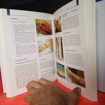 The evidence for vascular surgery evidencias para cirugía vascular