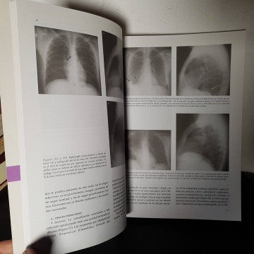 radiología torax libro neumología libros de medicina librería online