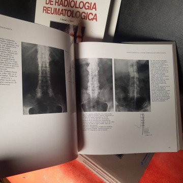 radiología reumatológica libro medicina atlas librería libros medicina