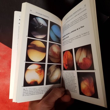 Artroscopia de la rodilla libros de medicina cirugia artroscopica