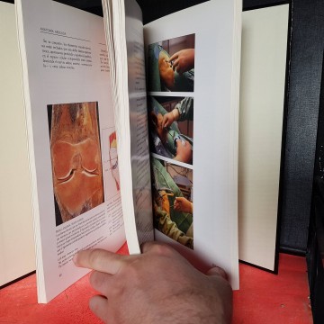 Rodilla: morfogénesis anatomía clínica y vías de acceso libro medicina