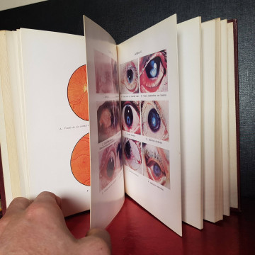 Manual de enfermedades de los ojos, James H. Allen oftalmología libros