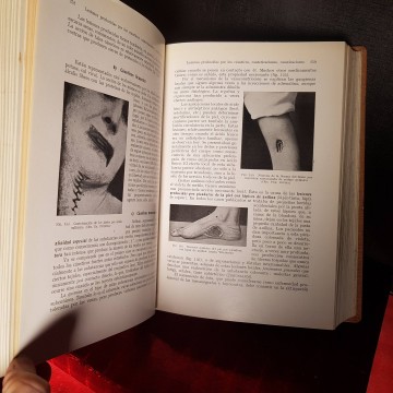 Tratado de patología quirúrgica general, dr. Manuel Bastos libro