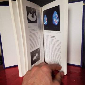 Libros angiología Manual de enfermedades vasculares cerebrales,