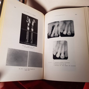Endodoncia, René m. Soler. libros odontología librería online
