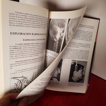 otología libros medicina librería online