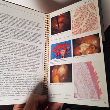 ESQUEMAS CLÍNICO VISUALES EN GINECOLOGÍA LIBROS MEDICINA