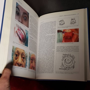 SUPERFICIE OCULAR, JOSÉ M. BENÍTEZ DEL CASTILLO SÁNCHEZ.