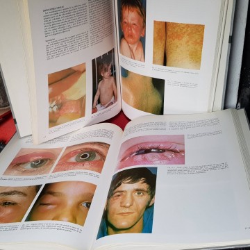 ATLAS FOTOGRÁFICO DE ENFERMEDADES INFECCIOSAS.