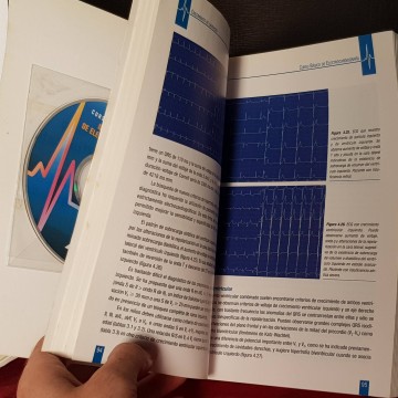 CURSO BÁSICO DE ELECTROCARDIOGRAFÍA, LUIS RODRÍGUEZ PADIAL.