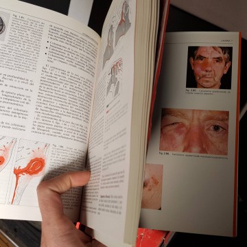 Otorrinolaringología, manual ilustrado.