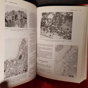 Anatomía e histología del ojo.