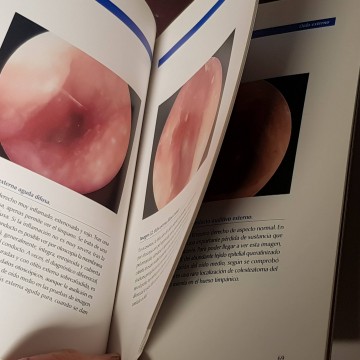 Atlas de otoscopia, Manuel Tapia Risueño.