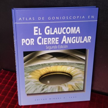 Atlas de gonioscopia en el glaucoma por cierre angular, Miguel A. Teus.
