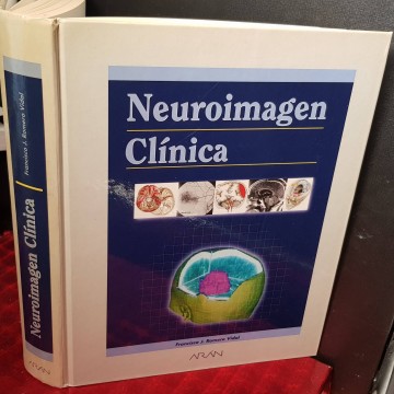 Neuroimagen clínica, Francisco J. Romero Vidal.