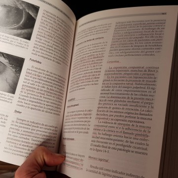 Síndrome de Sjögren, Manuel Ramos-Casals.