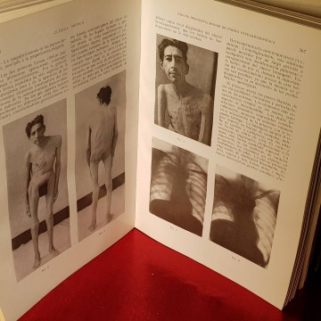Clínica médica, Fidel Schaposnik.
