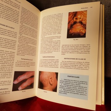 Manual Janssen de enfermedades de la piel, Carlos Guillén Barona.