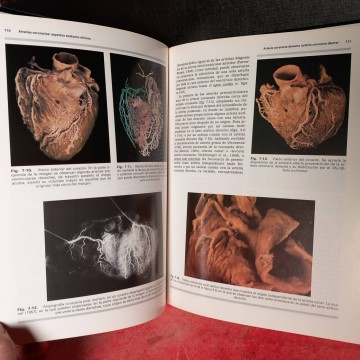 Arterias coronarias aspectos anatomo-clínicos, Màrius Petit i Guinovart.