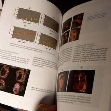 Teoría y práctica de la ecografía y angiografía Doppler tridimensional en obstetricia y ginecología.