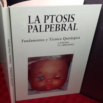 La ptosis palpebral, fundamentos y técnica quirúrgica, J. Junceda.