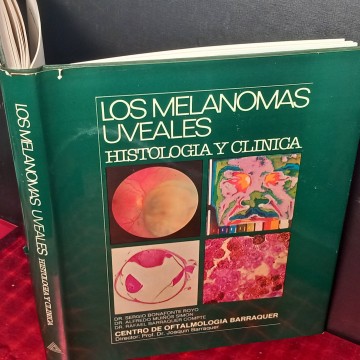 Los melanomas uveales, hsitología y clínica, Sergio Bonafonte Royo.