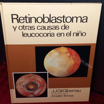 Retinoblastoma y otras causas de leucocoria en el niño, J.J. Gil Gibernau.