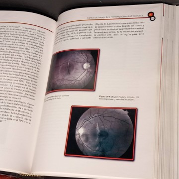 Cirugía de retina y vitreoretina, dominando las técnicas más avanzadas.