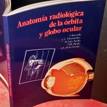 Anatomía radiológica de la órbita y globo ocular.