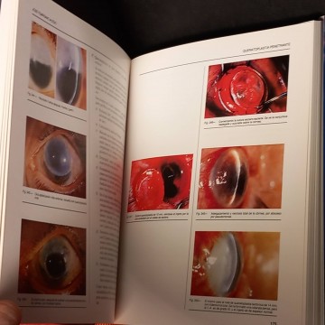 Queratoplastias y queratoprótesis, José Temprano Acedo.