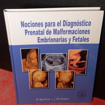 Nociones para el diagnóstico prenatal de malformaciones embrionarias y fetales, JM.Bajo Arenas.