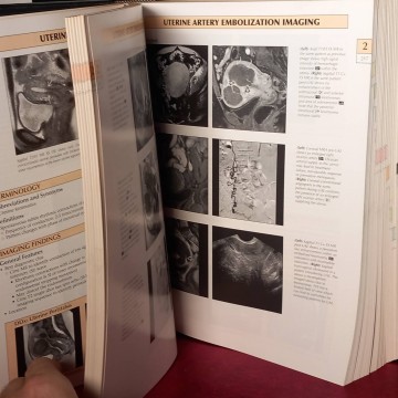 Diagnostic imaging: Gynecology, Hricak.