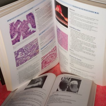 Atlas of gynecologic surgical pathology + Gynecology: top 100 diagnoses.