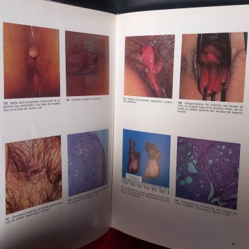 Atlas de coloproctología, Emilio de los Ríos Magriñá.