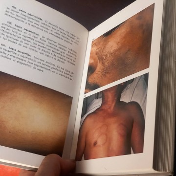 Atlas de dermatología, G.M. Levene.