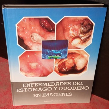 Enfermedades del estómago y duodeno en imágenes.
